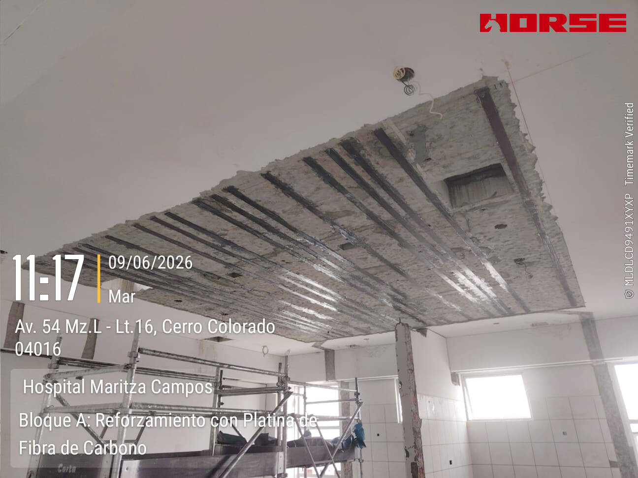 Refuerzo Sísmico de Losa de Hospital Mediante Placa de Fibra de Carbono